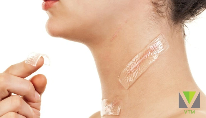 نحوه استفاده از سیلیکون شیت برای درمان اسکار و جای زخم