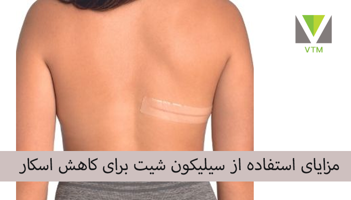 مزایای استفاده از سیلیکون شیت برای کاهش اسکار