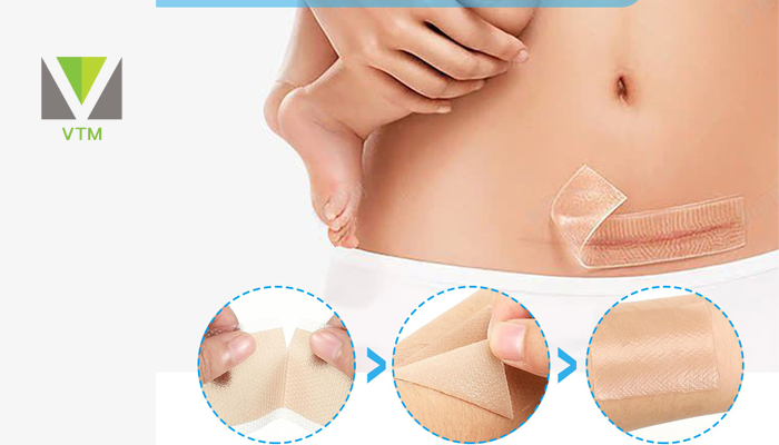 نحوه استفاده صحیح از سیلیکون شیت روی زخم‌ها
