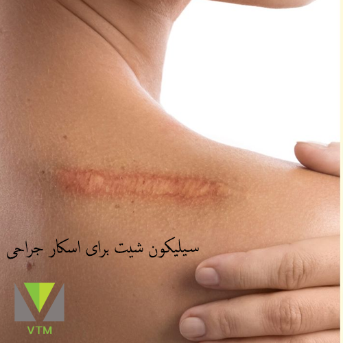 سیلیکون شیت