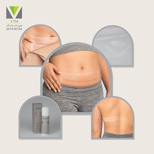 مزایای استفاده از سیلیکون شیت برای افراد کاندید