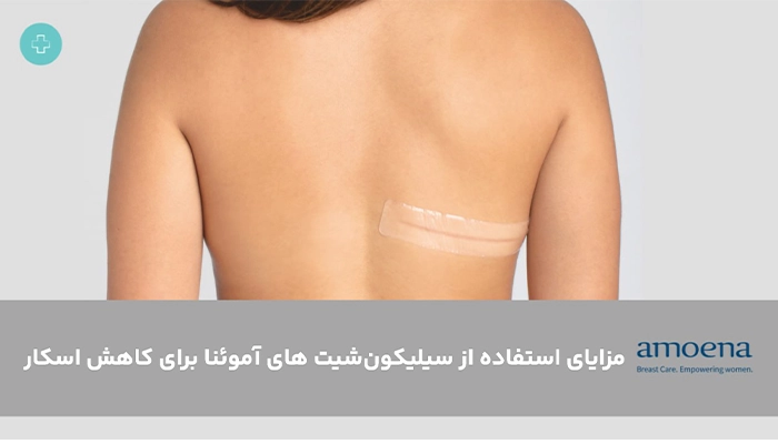 مزایای سیلیکون شیت آموئنا