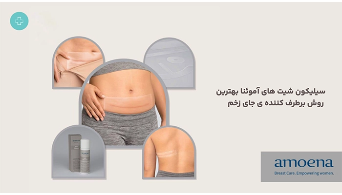 کاربردهای سیلیکون شیت آموئنا