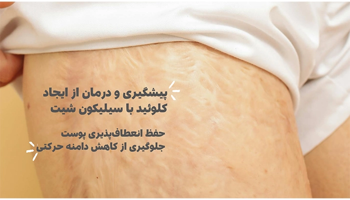 کاربرد سیلیکون