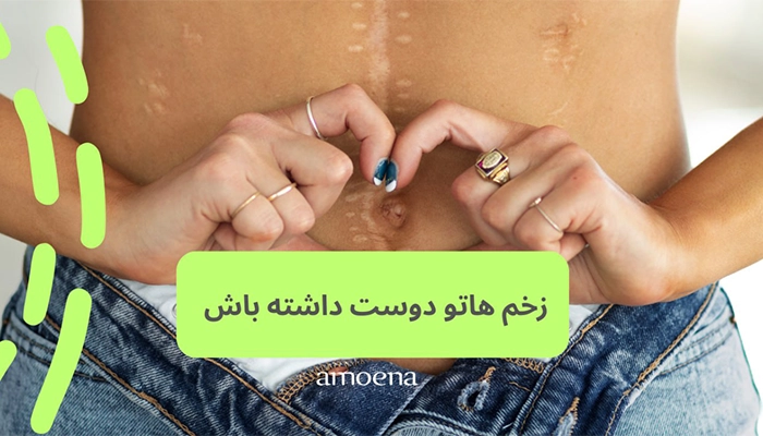 سیلیکون شیت برای درمان جای زخم
